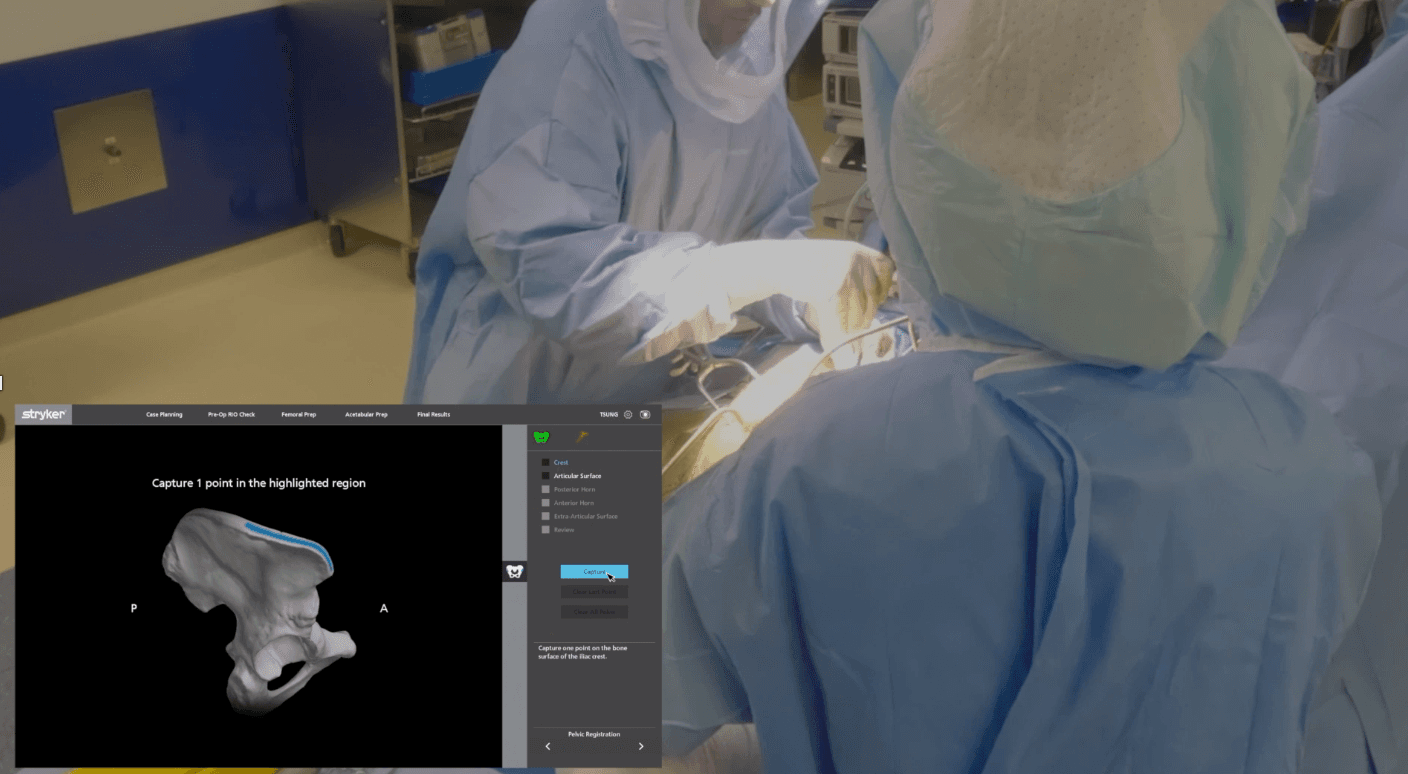 Robotic-assisted hip replacement via the direct superior approach